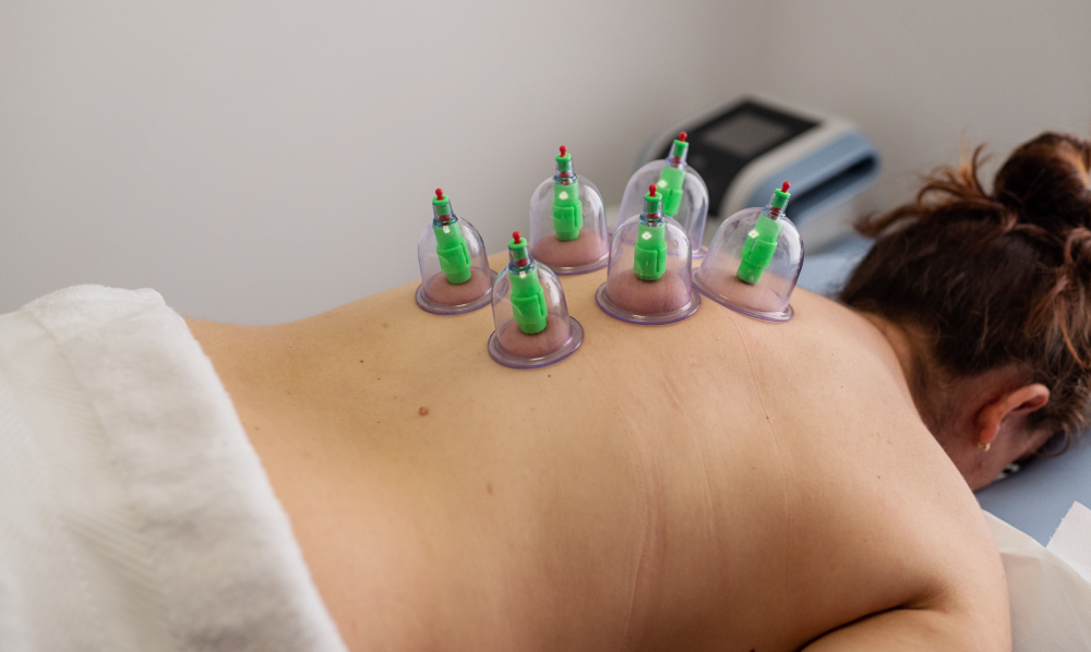 Cupping massage in Dubai